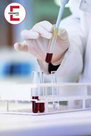 STI-Labortest anonym von Zuhause aus