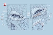 Vaginoplastik