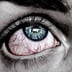 Syphilis im Auge: Zu viele Pornos geschaut?