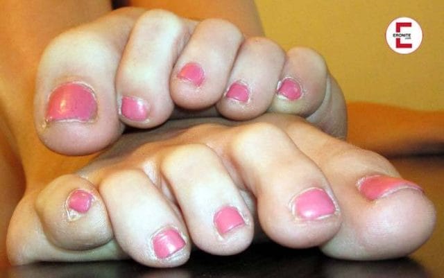 Frau mit Klumpfüßen verwöhnt Fußfetischisten