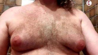 Hilfe - Meine Männerbrüste quälen mich