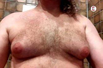 Hilfe - Meine Männerbrüste quälen mich