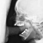 Faszinierend: Röntgen-Blowjob zeigt Details