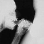 Fascinating: X-ray blowjob shows details