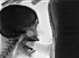 Fascinante: La mamada de rayos X muestra detalles
