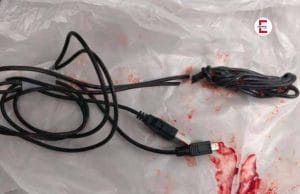 15 year old puts whole USB cable in his penis